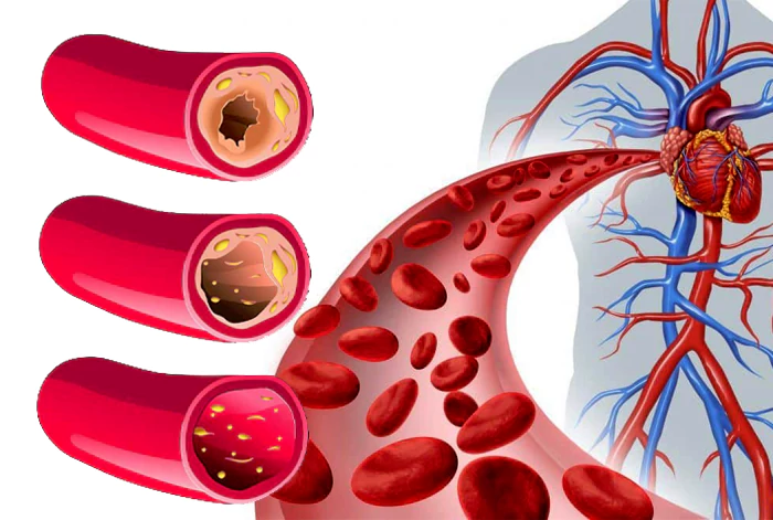 Tecnología de Terahercios Impacto en los Trastornos Cardiovasculares y de la Sangre